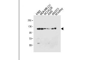 All lanes : Anti-ROR1 Antibody at 1:4000 dilution Lane 1: K562 whole cell lysate Lane 2: MDA-MB-231 whole cell lysate Lane 3: NCI- whole cell lysate Lane 4: A549 whole cell lysate Lane 5: NIH/3T3 whole cell lysate Lane 6: Mouse kidney tissue lysate Lysates/proteins at 20 μg per lane. (ROR1 anticorps)