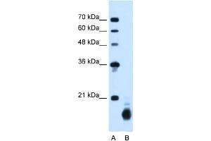 WB Suggested Anti-PPIB Antibody Titration:  1. (PPIB anticorps  (C-Term))