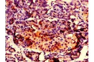 Immunohistochemistry of paraffin-embedded human pancreatic tissue using ABIN7167217 at dilution of 1:100 (RAB1A anticorps  (AA 1-196))