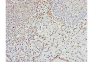 Immunohistochemistry of paraffin-embedded human tonsil tissue using ABIN7152135 at dilution of 1:100 (EIF2S3 anticorps  (AA 173-472))