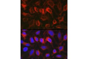 Immunofluorescence analysis of HeLa cells using G6PD Rabbit pAb (ABIN3022094, ABIN3022095, ABIN3022096 and ABIN6218601) at dilution of 1:100 (40x lens). (Glucose-6-Phosphate Dehydrogenase anticorps  (AA 246-545))