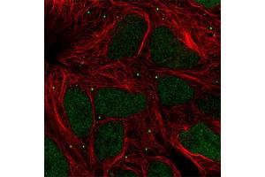 Immunofluorescent staining of human cell line HEK 293 with IFITM1 polyclonal antibody  at 1-4 ug/mL concentration shows positivity in nucleus and vesicles. (TIPIN anticorps)