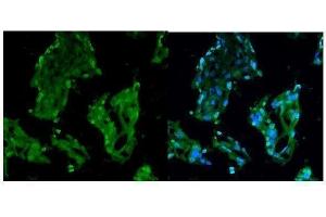 IHC analysis of RCC1 using anti-RCC1 antibody (ABIN7600024). (RCC1 anticorps  (AA 14-421))