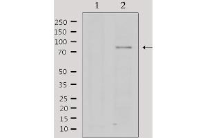 Western blot analysis of extracts from rat brain, using PRMT5 Antibody.
