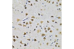 Immunohistochemistry of paraffin-embedded rat brain using LGALS3 Antibody (ABIN5970683) at dilution of 1/200 (40x lens). (Galectin 3 anticorps)