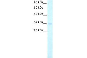 WB Suggested Anti-MSX1 Antibody Titration: 2. (MSX1 anticorps  (Middle Region))