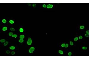 Immunofluorescent analysis of Hela cells using ABIN7139668 at dilution of 1:100 and Alexa Fluor 488-congugated AffiniPure Goat Anti-Rabbit IgG(H+L) (HIST1H3A anticorps  (3meLys27))