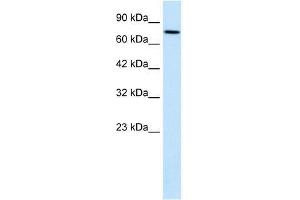WHSC1 antibody used at 1. (WHSC1 anticorps  (N-Term))