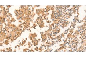 Immunohistochemistry of paraffin-embedded Human tonsil using NAP1L1 Polyclonal Antibody at dilution of 1:70 (NAP1L1 anticorps)
