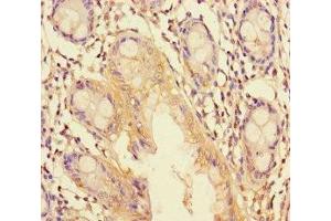 Immunohistochemistry of paraffin-embedded human colon tissue using ABIN7151266 at dilution of 1:100 (TRIM37 anticorps  (AA 301-600))