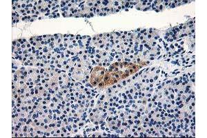 Immunohistochemical staining of paraffin-embedded Human pancreas tissue using anti-TBC1D21 mouse monoclonal antibody. (TBC1D21 anticorps)
