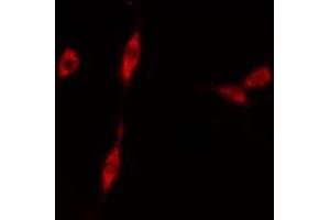 ABIN6274135 staining Hela cells by IF/ICC.