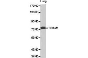 Western Blotting (WB) image for anti-Toll-Like Receptor Adaptor Molecule 1 (TICAM1) antibody (ABIN1875095)