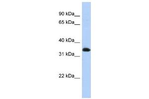 WB Suggested Anti-ZNF511 Antibody Titration:  0. (ZNF511 anticorps  (N-Term))