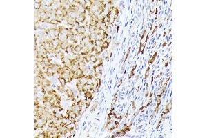 Immunohistochemistry of paraffin-embedded rat ovary using BMPR1B Rabbit pAb (ABIN3022719, ABIN3022720, ABIN3022721, ABIN1512645 and ABIN6219169) at dilution of 1:350 (40x lens). (BMPR1B anticorps  (AA 1-126))