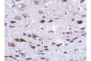 Immunohistochemistry of Bora in mouse brain tissue with Bora antibody at 2.