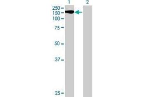 Lane 1: STK11IP transfected lysate ( 121 KDa) Lane 2: Non-transfected lysate. (STK11IP 293T Cell Transient Overexpression Lysate(Denatured))
