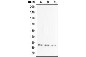 Western blot analysis of TSG6 expression in MCF7 (A), HCT15 (B), HeLa (C) whole cell lysates.