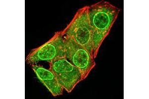 Immunofluorescence analysis of Hela cells using ATG5 mouse mAb (green). (ATG5 anticorps  (AA 144-275))