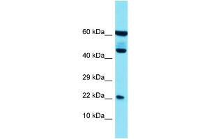 Host: Rabbit Target Name: PLA2G12B Sample Type: HT1080 Whole Cell lysates Antibody Dilution: 1.
