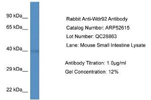 Western Blotting (WB) image for anti-WD Repeat Domain 92 (WDR92) (Middle Region) antibody (ABIN2785012) (WDR92 anticorps  (Middle Region))