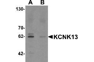 Western blot analysis of KCNK13 in rat brain tissue lysate with KCNK13 antibody at 0. (KCNK13 anticorps  (Middle Region))