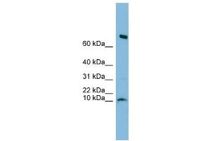 C1orf122 antibody used at 1 ug/ml to detect target protein. (C1orf122 anticorps  (N-Term))