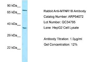 Western Blotting (WB) image for anti-Melatonin Receptor 1B (MTNR1B) (N-Term) antibody (ABIN2789720) (Melatonin Receptor 1B anticorps  (N-Term))