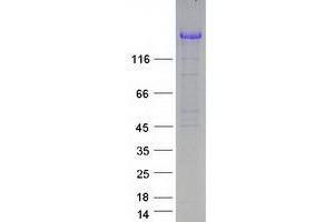 Validation with Western Blot