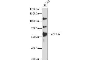Western blot analysis of extracts of K-562 cells, using ZNF517 antibody (ABIN7271495) at 1:1000 dilution. (ZNF517 anticorps  (AA 70-180))