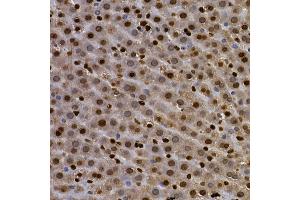 Immunohistochemistry of paraffin-embedded rat lung using AHR Rabbit pAb (ABIN3015499, ABIN3015500, ABIN5663909 and ABIN6218543) at dilution of 1:100 (40x lens).