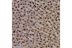 Immunohistochemistry of paraffin-embedded rat lung using AHR Rabbit pAb (ABIN3015499, ABIN3015500, ABIN5663909 and ABIN6218543) at dilution of 1:100 (40x lens). (Aryl Hydrocarbon Receptor anticorps  (AA 619-848))