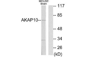 Western Blotting (WB) image for anti-A Kinase (PRKA) Anchor Protein 10 (AKAP10) (N-Term) antibody (ABIN1848976)