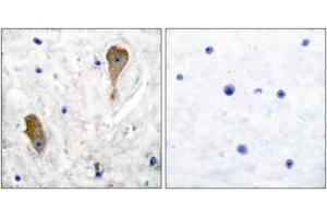 Immunohistochemistry analysis of paraffin-embedded human brain tissue, using GAD1 Antibody. (GAD anticorps  (AA 471-520))