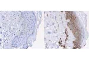 Immunohistochemistry of Rabbit anti-Beta-2-Microglobulin Antibody.