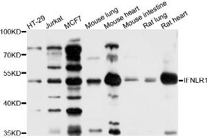 Western blot analysis of extracts of various cell lines, using IFNLR1 antibody (ABIN6003788) at 1/1000 dilution. (IL28RA anticorps)