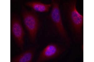 Immunofluorescence staining of methanol-fixed Hela cells using SEK1/MKK4(Phospho-Ser80) Antibody.