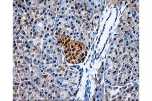 Immunohistochemical staining of paraffin-embedded Kidney tissue using anti-PSMC3mouse monoclonal antibody. (PSMC3 anticorps)
