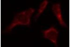 ABIN6274096 staining HepG2 by IF/ICC. (EPH Receptor B6 anticorps  (Internal Region))