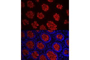 Immunofluorescence analysis of human colon carcinoma cells using MUC2 Rabbit pAb (ABIN7268690) at dilution of 1:50 (40x lens). (MUC2 anticorps  (AA 4850-4950))
