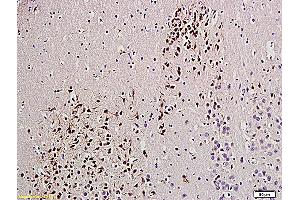 Formalin-fixed and paraffin embedded rat brain labeled with Anti-UCHL1/PGP9. (UCHL1 anticorps  (AA 35-140))