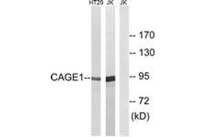 Western blot analysis of extracts from HT-29/Jurkat cells, using CAGE1 Antibody. (CAGE1 anticorps  (AA 711-760))