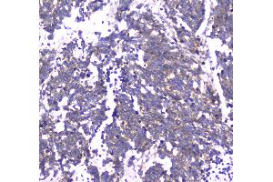 IHC analysis of RAB27A using anti-RAB27A antibody .