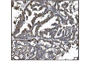 IHC analysis of FABP-1/GOT2 using anti-FABP-1/GOT2 antibody (ABIN7601426). (GOT2 anticorps  (AA 35-430))