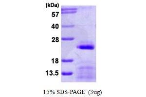SDS-PAGE (SDS) image for Small Nuclear Ribonucleoprotein Polypeptide C (SNRPC) (AA 1-159) protein (His tag) (ABIN7279644)