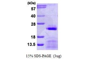 SDS-PAGE (SDS) image for Small Nuclear Ribonucleoprotein Polypeptide C (SNRPC) (AA 1-159) protein (His tag) (ABIN667625) (SNRPC Protein (AA 1-159) (His tag))