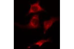 ABIN6275440 staining HuvEc cells by IF/ICC. (Radixin anticorps  (Internal Region))