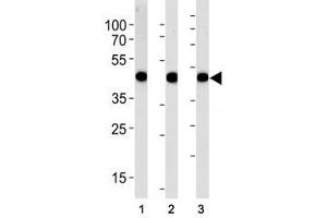 Alpha Actin antibody western blot analysis in (1) A549, (2) RD, and (3) human placenta lysate