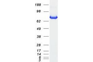 Validation with Western Blot
