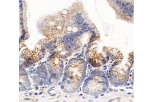 Immunohistochemistry analysis of paraffin-embedded mouse duodenum using,Arg2 (ABIN7073115) at dilution of 1: 600